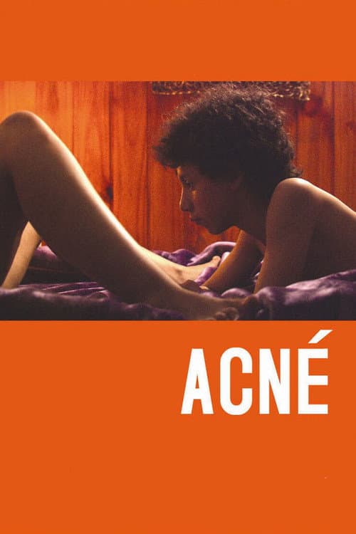 Постер: Acné