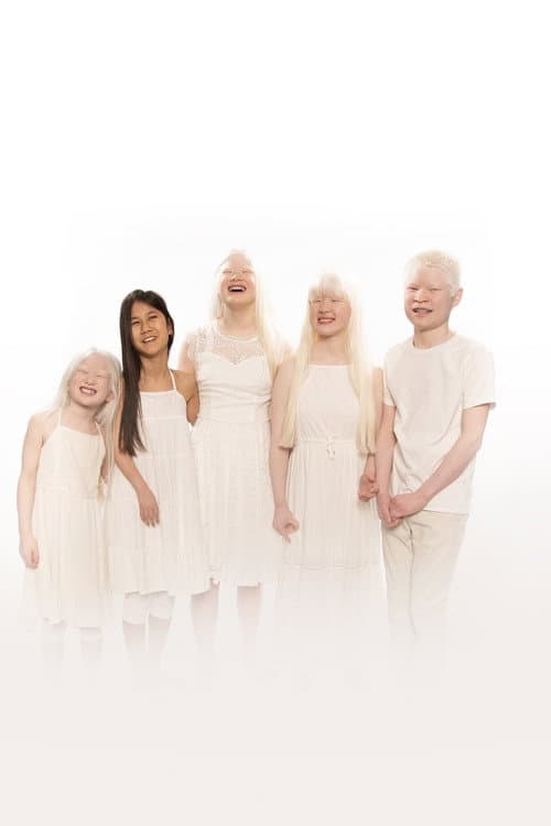 Постер: Born with Albinism