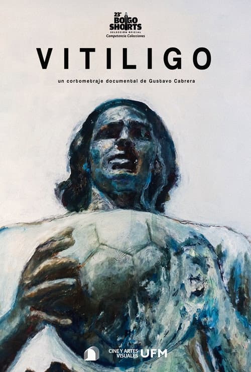 Постер: Vitiligo