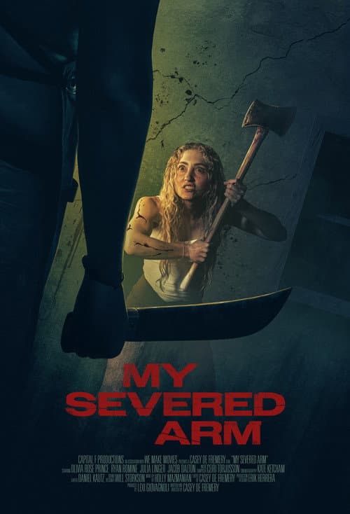 Постер: My Severed Arm