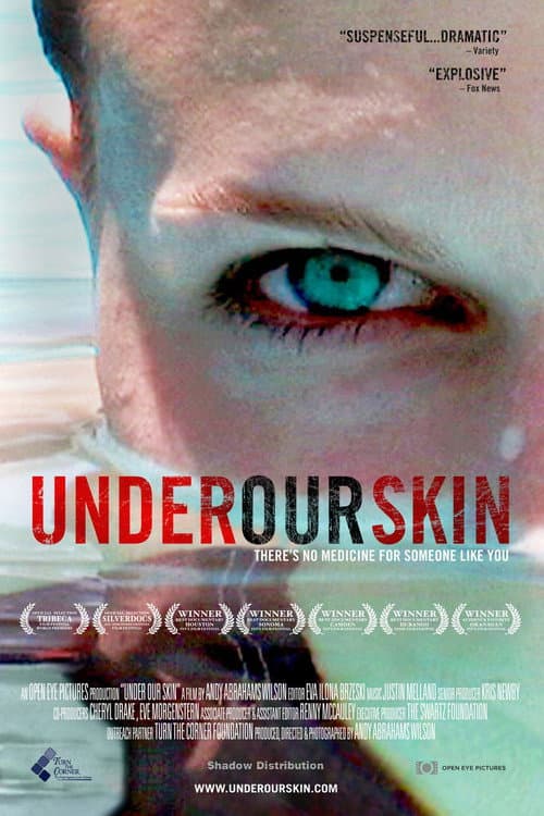 Постер: Under Our Skin