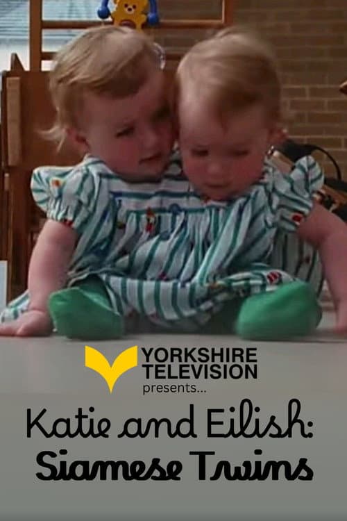Постер: Katie and Eilish: Siamese Twins